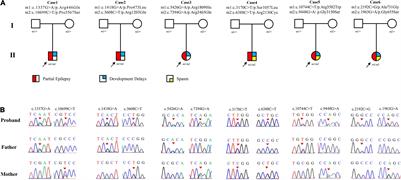 Recessive LAMA5 Variants Associated With Partial Epilepsy and Spasms in Infancy